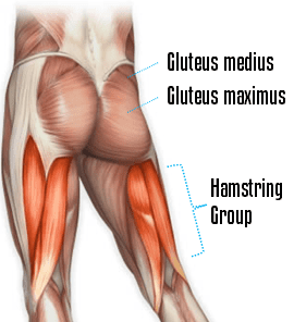 weak hamstrings and glutes can cause back pain